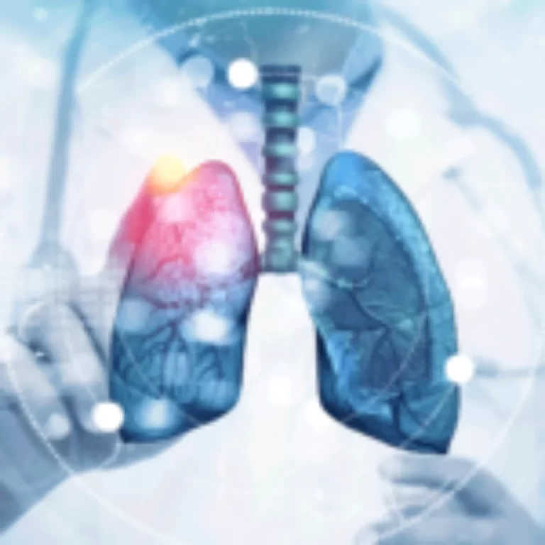Enfermedades Broncopulmonares